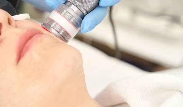 PICO Laser Whitening & Fractional PICO Laser Whitening & Fractional